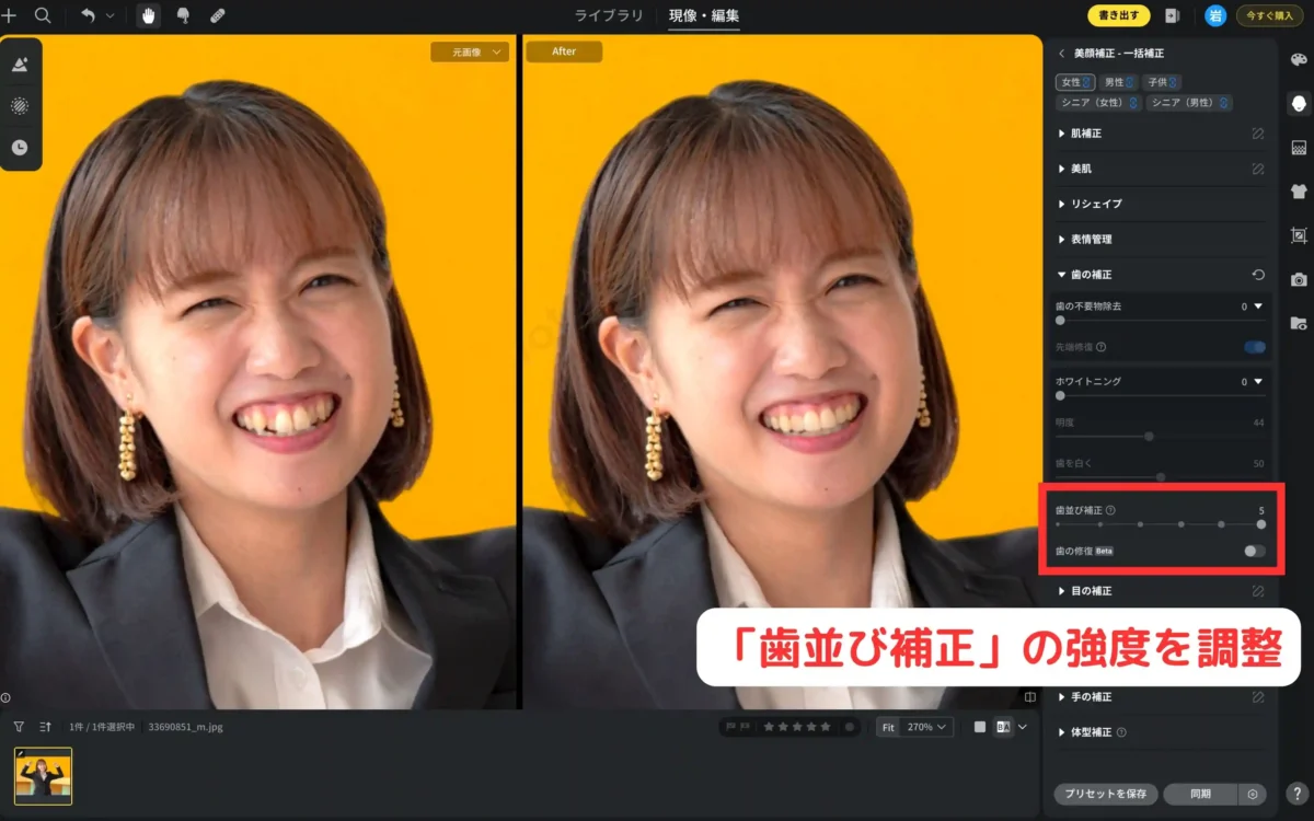歯並び補正スライダーを調整している編集画面