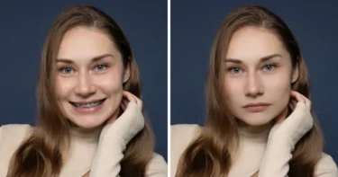 close mouth in photo before and after