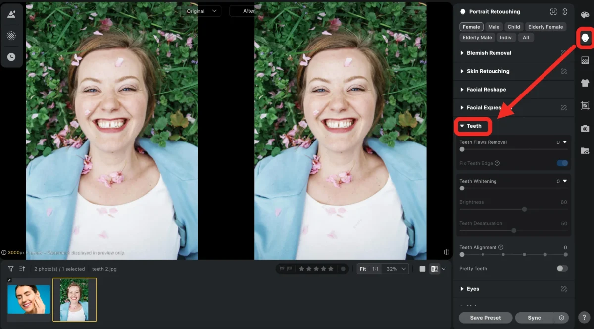 Teeth Adjustment