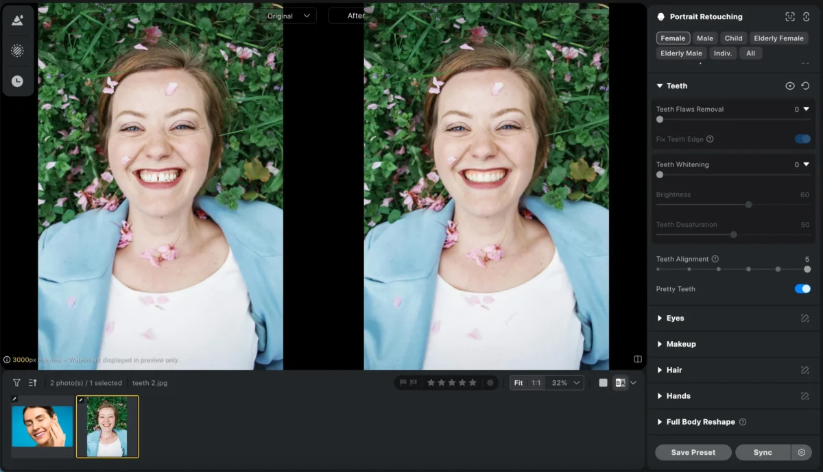  Align Teeth with AI