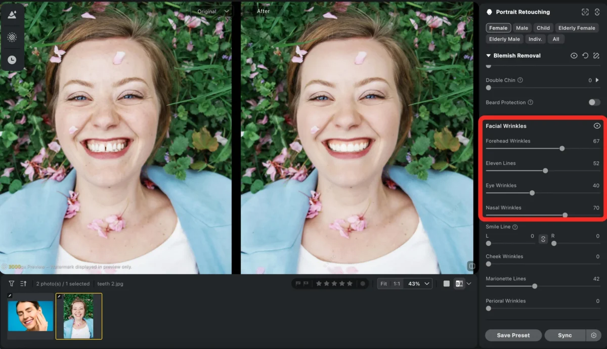 skin retouching