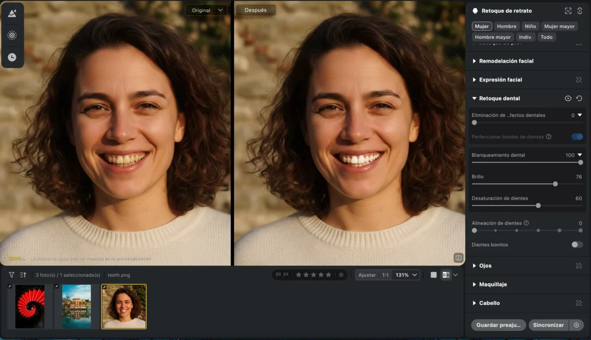 20251229172340 Blanqueamiento Dental