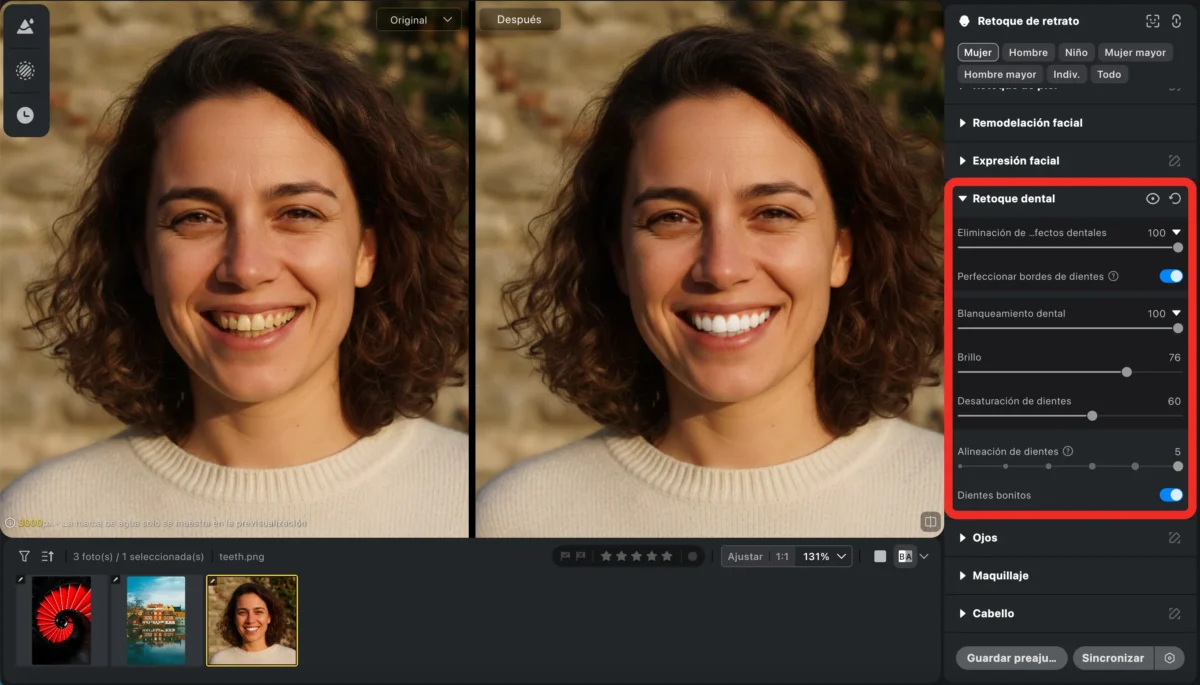 20251229172413 imperfectos dentales