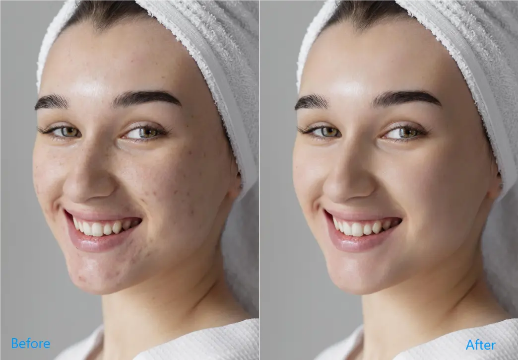 mejor-editor-de-fotos-para-eliminar-manchas Mejor Editor de Fotos para Eliminar Manchas