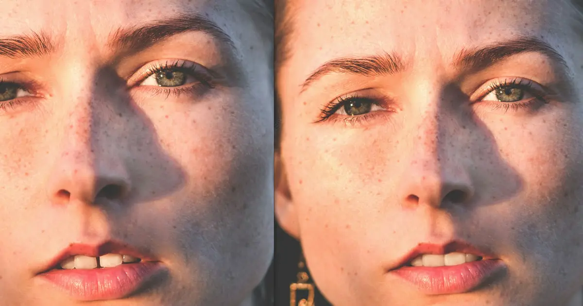 Online kostenlose Zahnkorrektur von Evoto AI