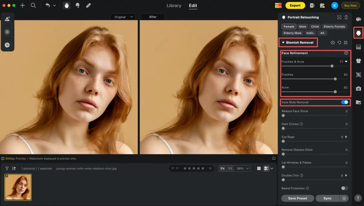 Remove Face Blemishes on Photos with Evoto