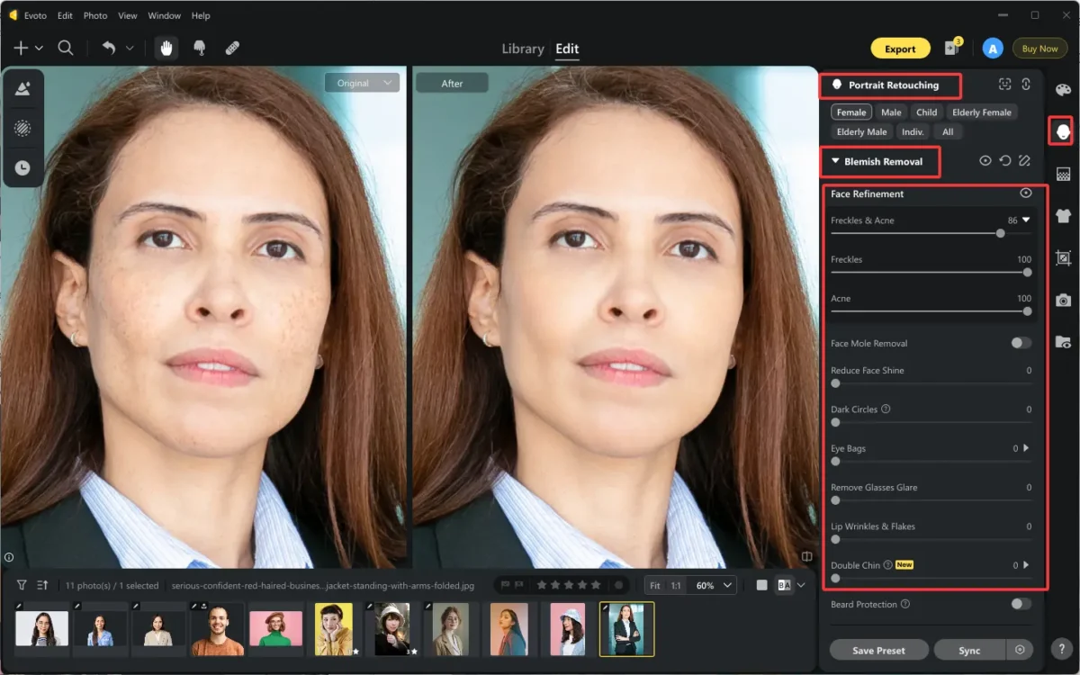 Remove Face Blemishes on Portraits with Evoto