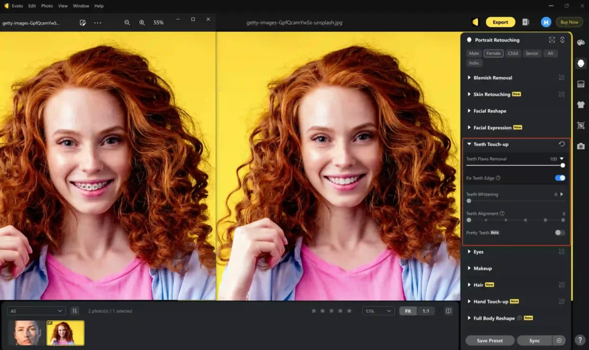Entfernen von Zahnfehlern