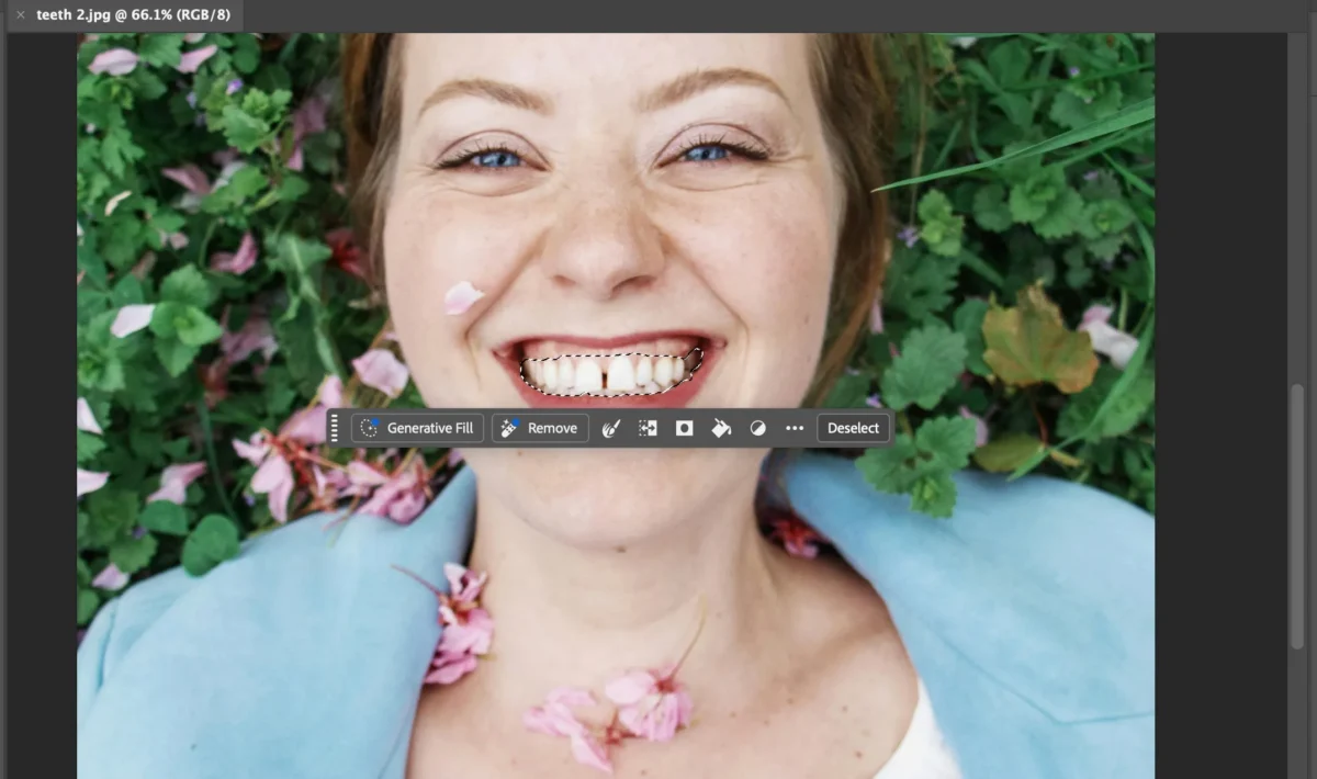 Select the Teeth 1