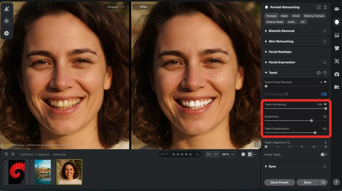 Use the Teeth Whitening Feature Use the Teeth Whitening Feature