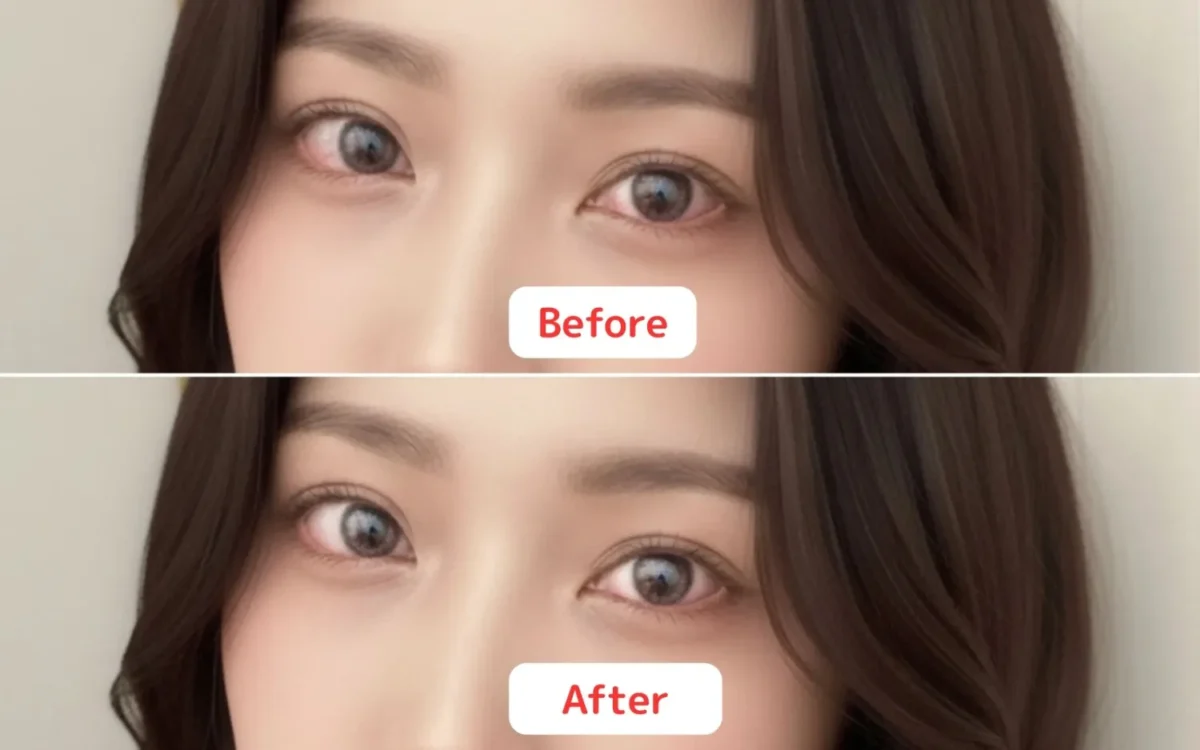 before after eye redness correction