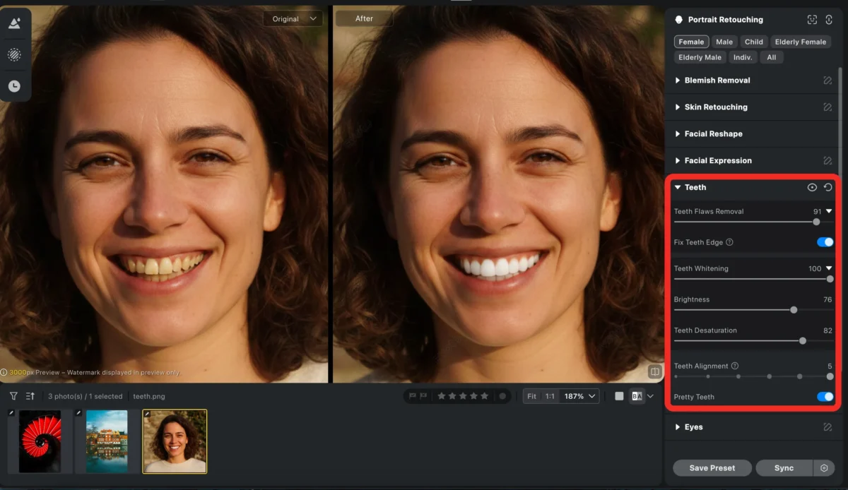 teeth pretty teeth pretty