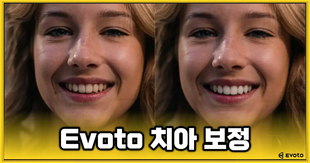 Evoto AI 치아 보정을 적용한 전후 비교 이미지로 자연스러운 미백 효과를 보여주는 예시