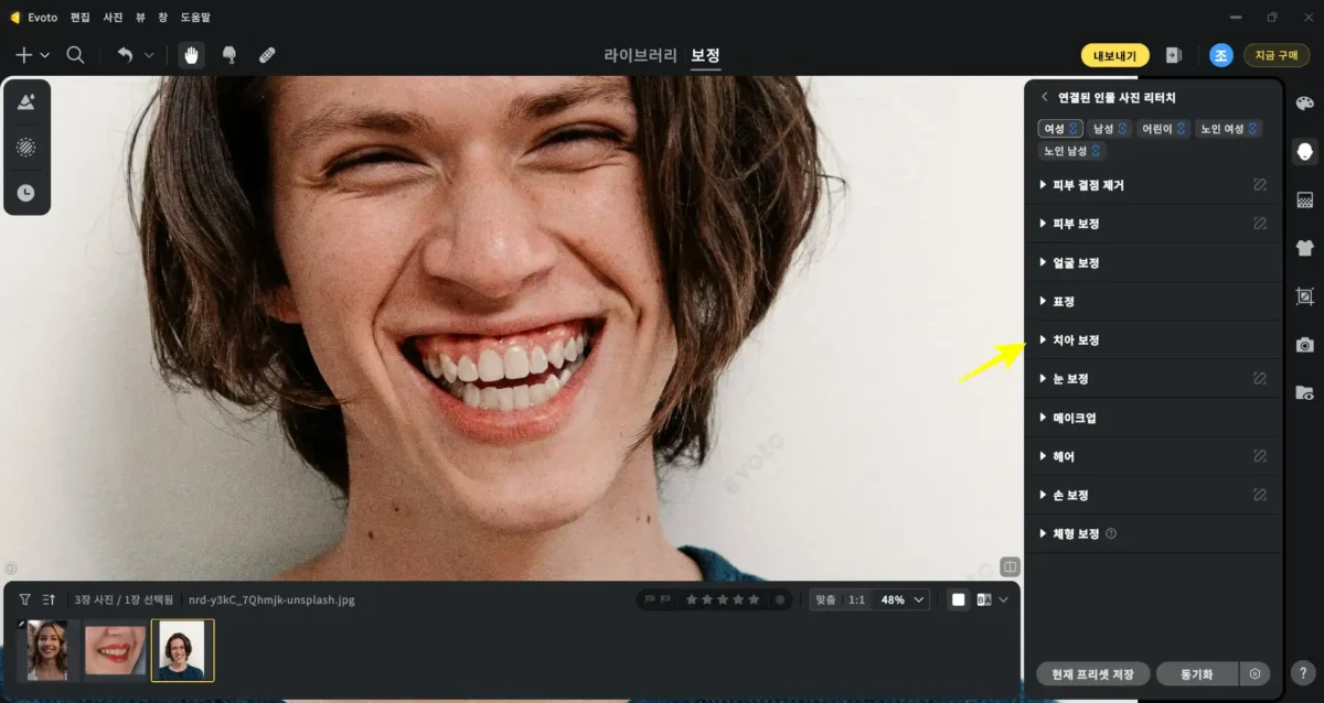 teeth whitening 3 Evoto 프로그램의 AI 치아 보정 기능 메뉴와 인터페이스가 표시된 화면