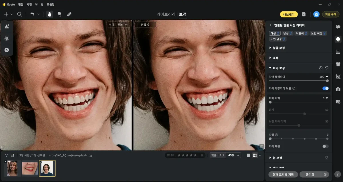 teeth whitening 4 Evto에서 AI 치아 미백 강도를 높여 밝기와 톤 변화를 확인할 수 있는 편집 인터페이스