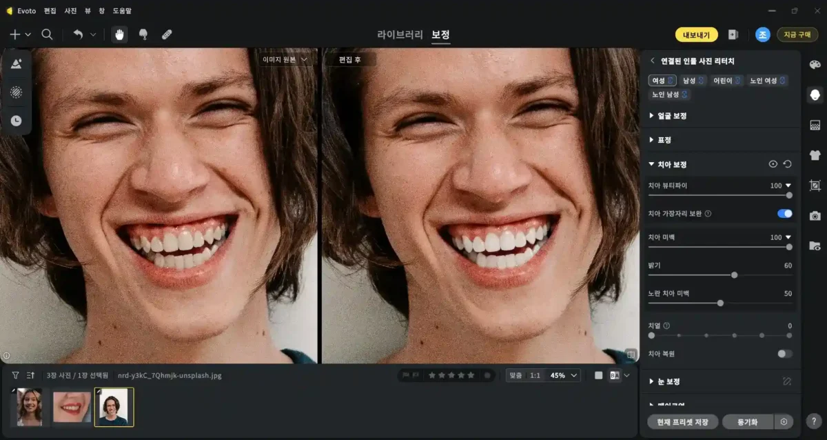 teeth whitening 5 Evoto AI 치아 보정 기능으로 치아 뷰티파이와 미백 조정을 적용한 전후 비교 화면