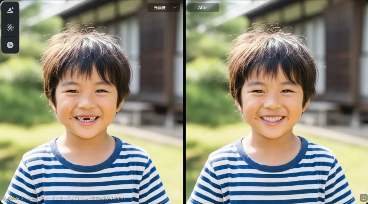 子どもの抜け歯写真修正