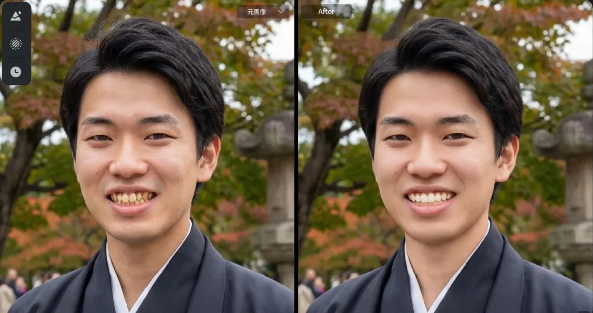 成人式写真の歯の補正