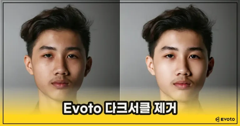 다클서클 제거 전후 예시