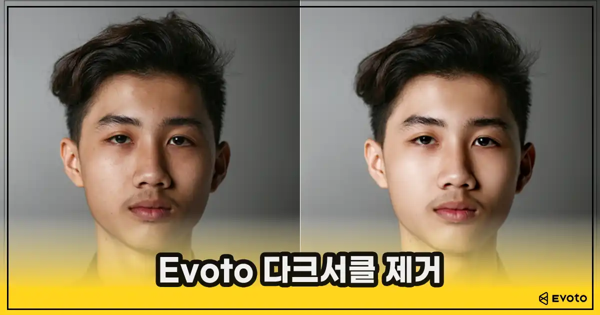 다클서클 제거 전후 예시