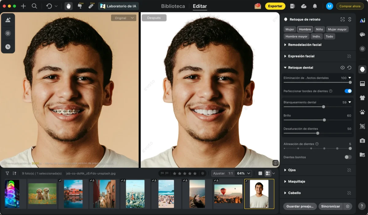 Editar dientes