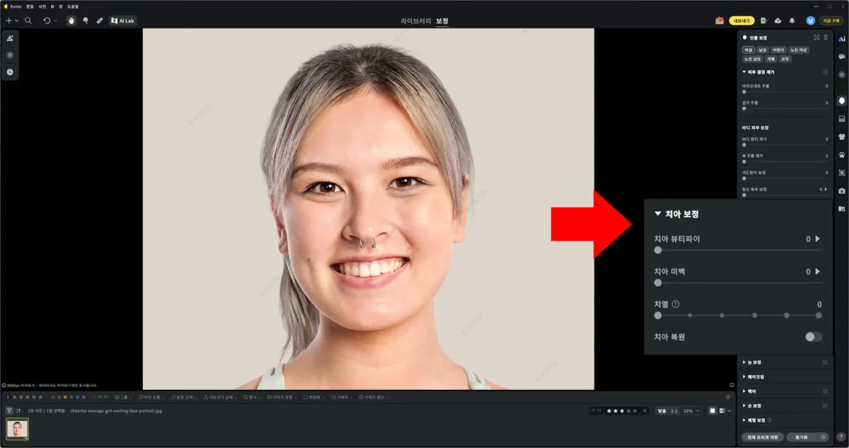 Evoto 치아 보정 1단계
