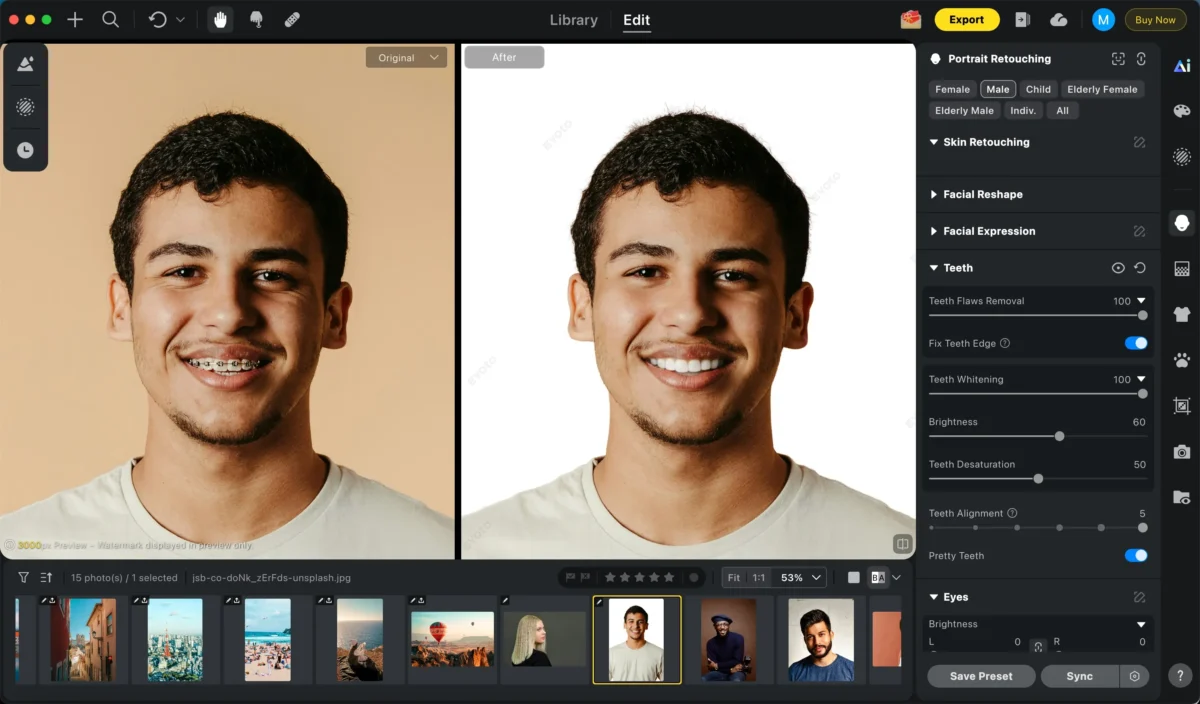 edit teeth