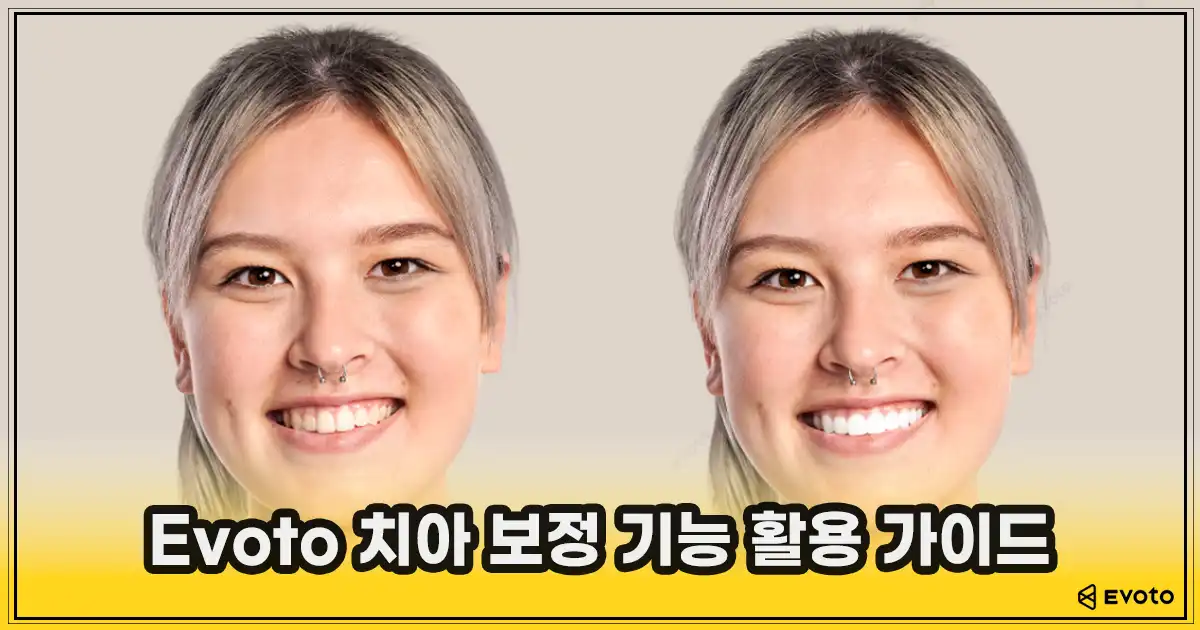 이보토 썸네일_치아 보정