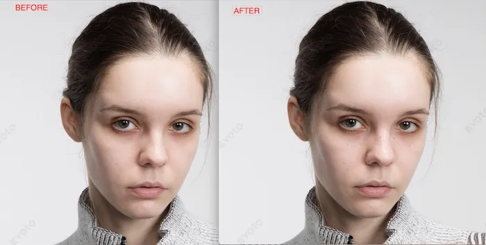 Efeito final ao adicionar sardas à foto com IA