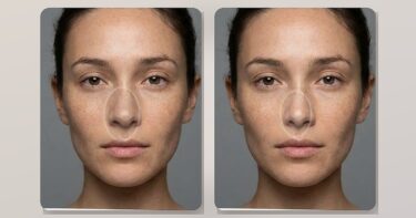 how to make nose look smaller