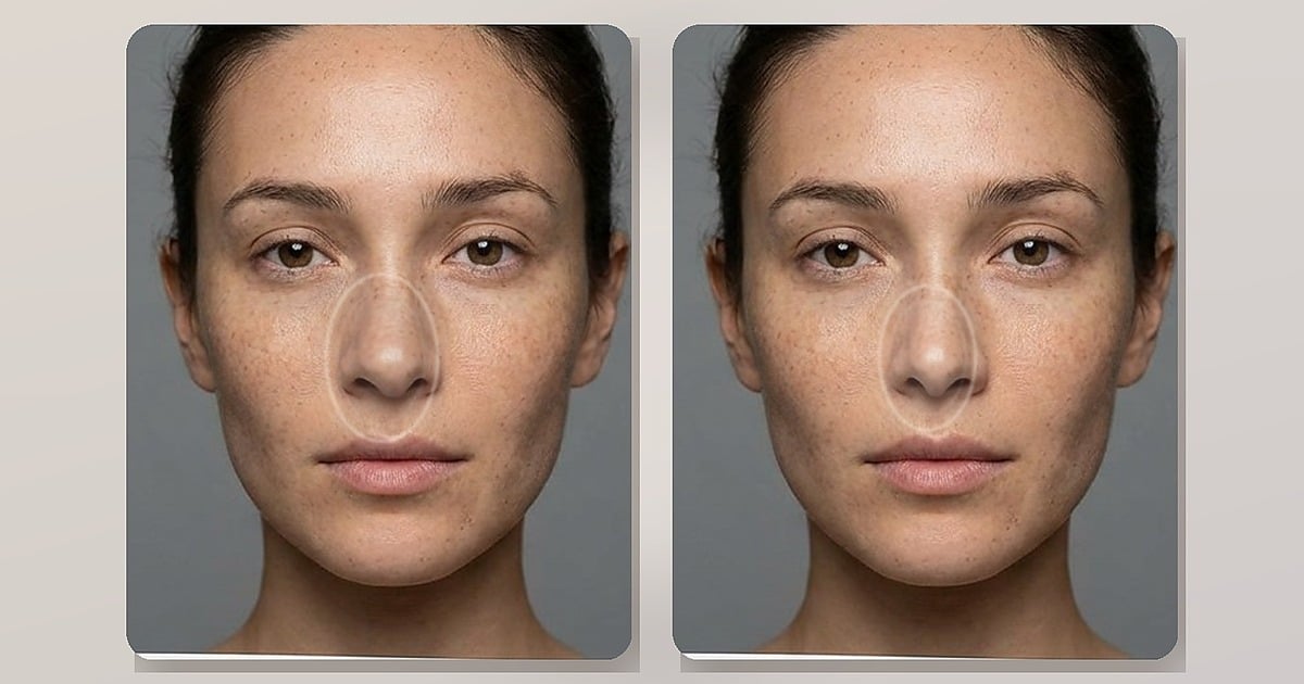 How to Make a Nose Look Smaller in Photos: Five Techniques from Lighting to AI Sliders