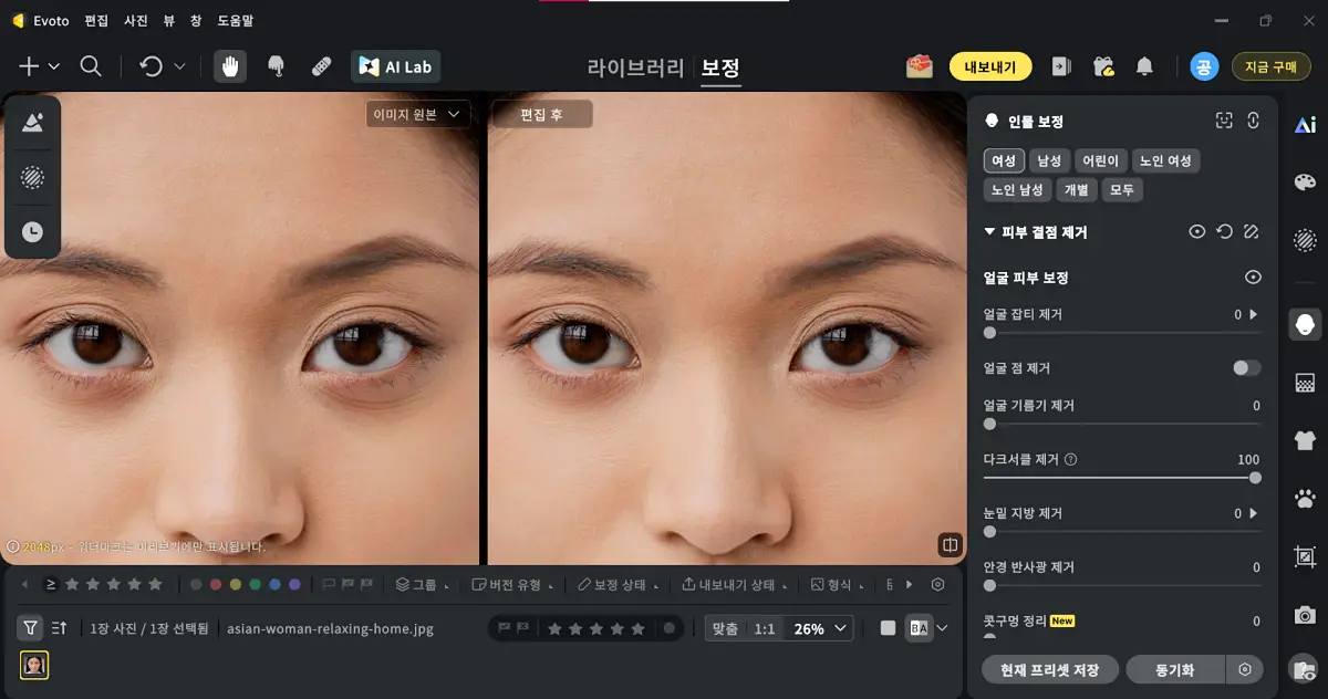눈밑 어두운 부분 제거 방법