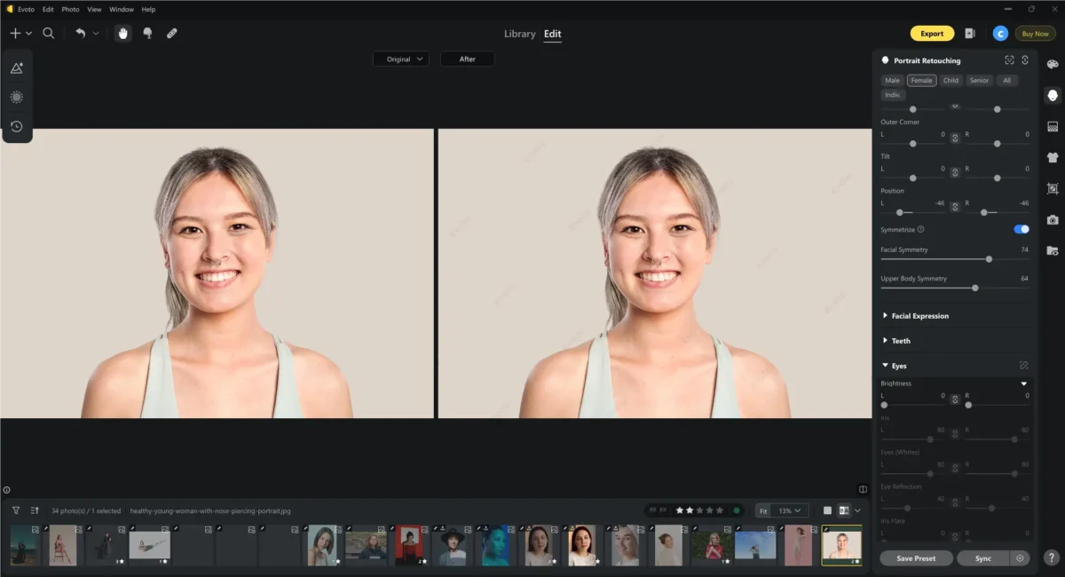 Comparação antes e depois da correção de assimetria facial