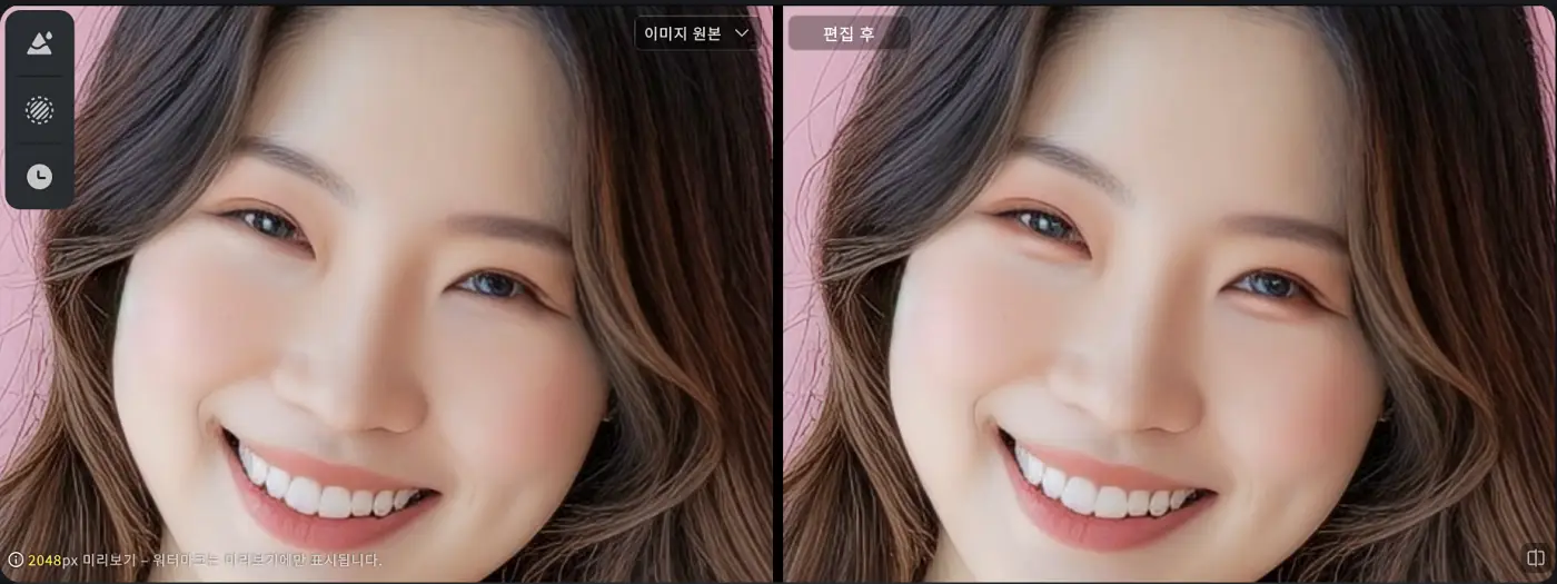 AI 애교살 보정 비포 애프터