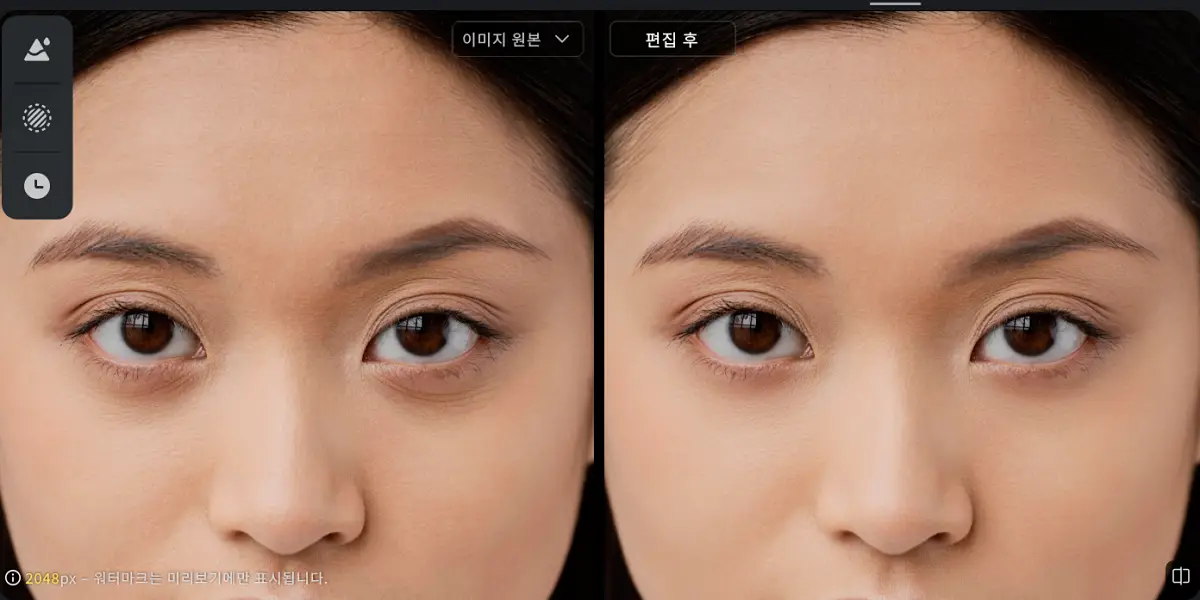 다크서클 자연스럽게 제거하는 방법