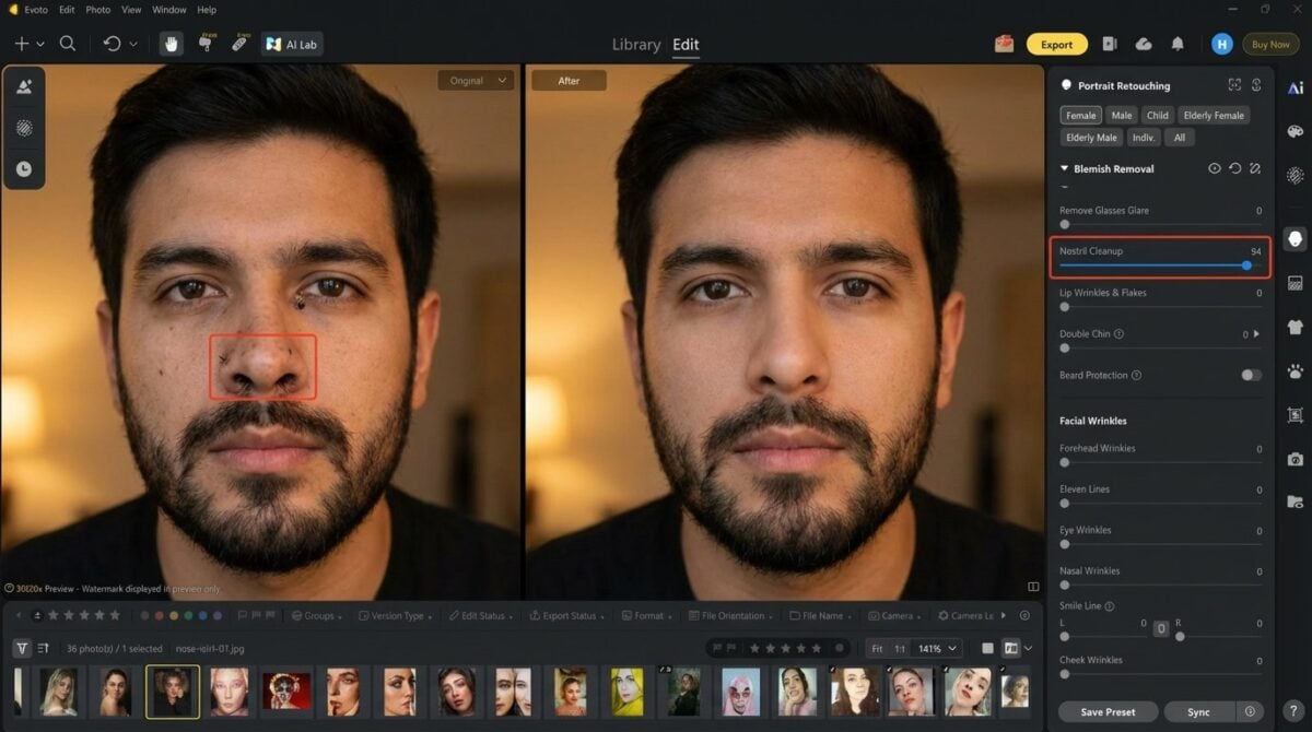 Ferramenta de limpeza das narinas no Evoto Desktop