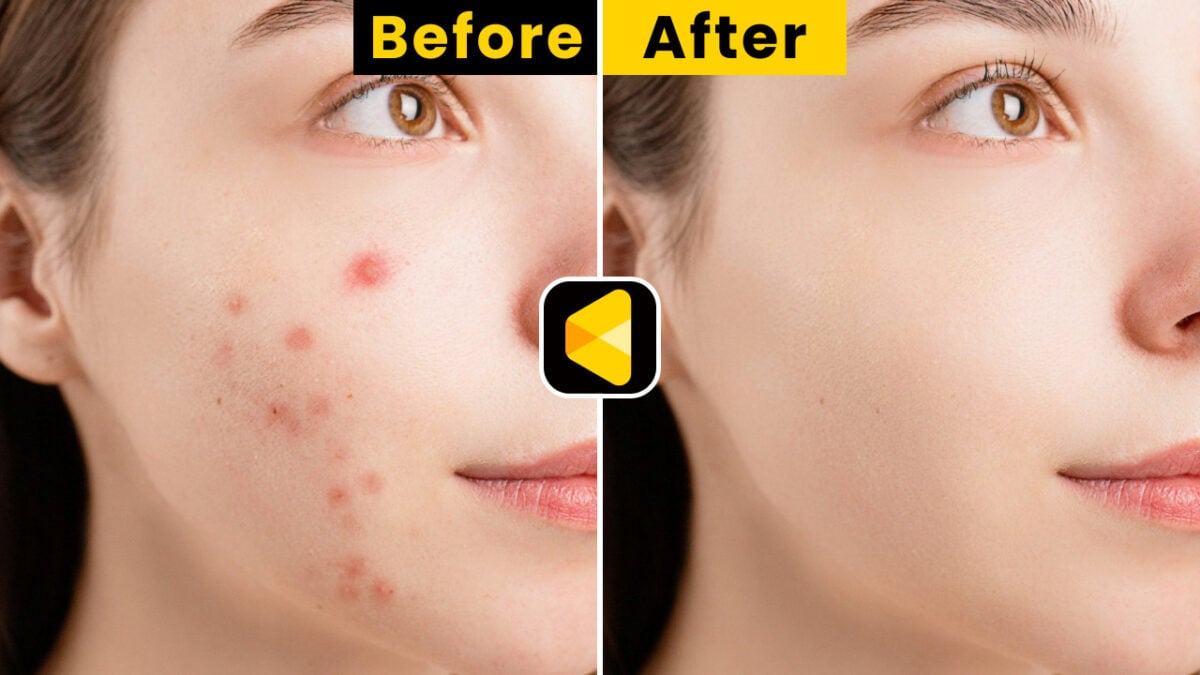 youtube-remove- blemishes