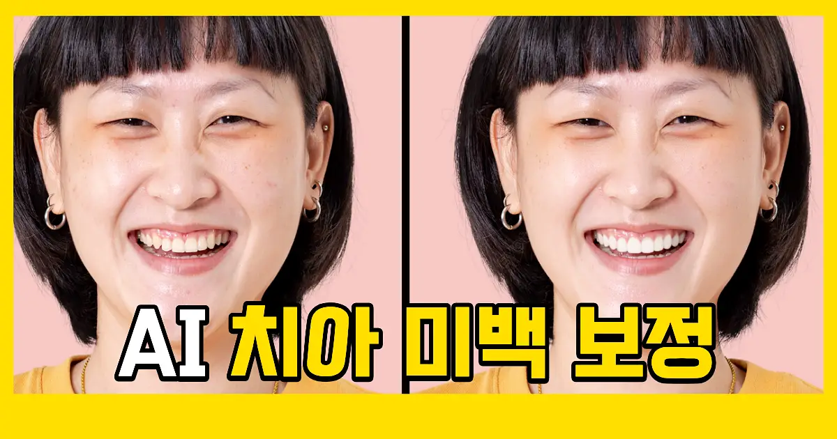 사진 치아 보정 프로그램