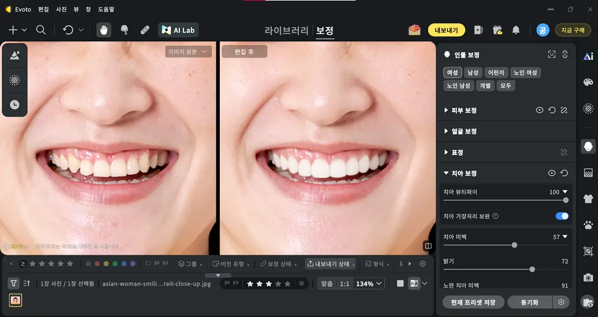 치아 톤 보정 치아 누런색 제거 사진