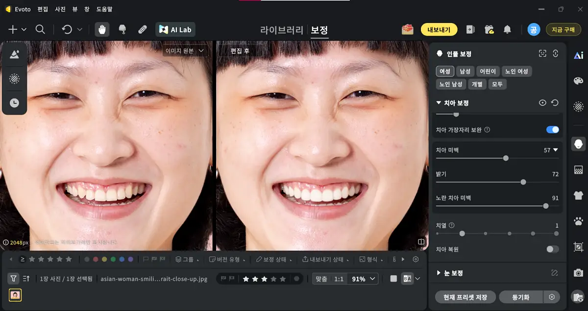 치아 하얗게 만들기 사진