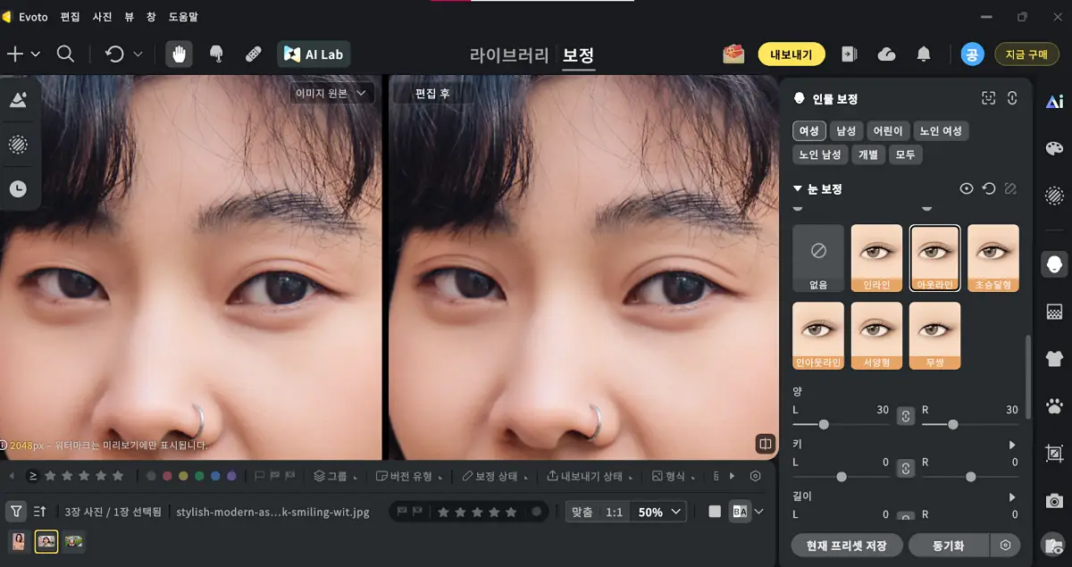 눈 대칭 보정 쌍꺼풀 보정