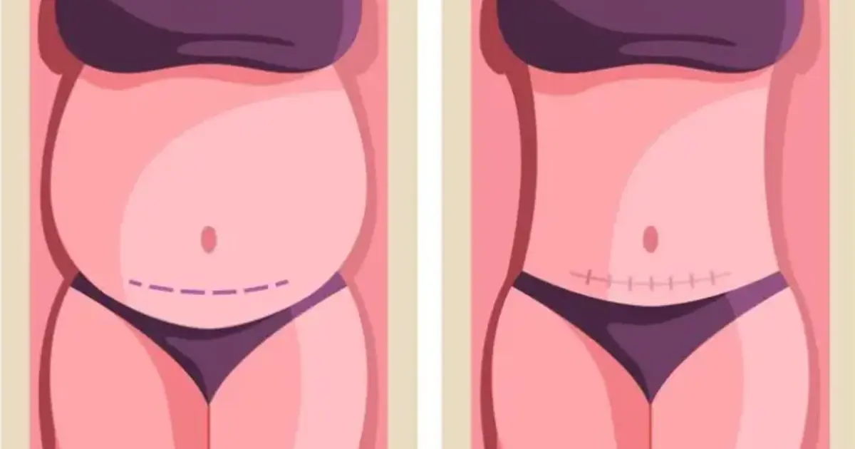 Aplicativo para Emagrecer Foto: Como Afinar Corpo, Cintura e Rosto com IA (Guia 2026)