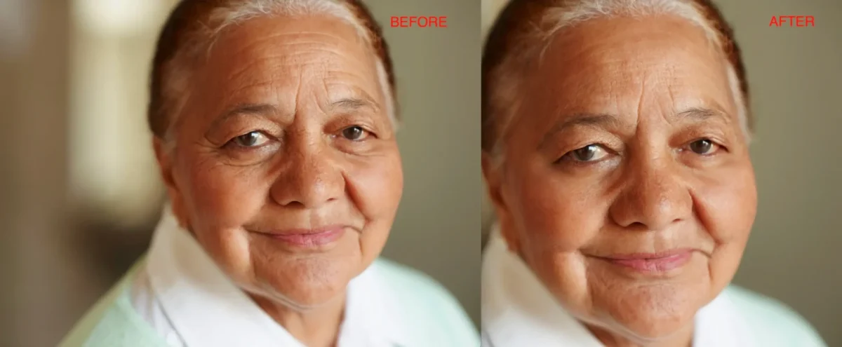 arrugas de los ojos y arrugas del cuello