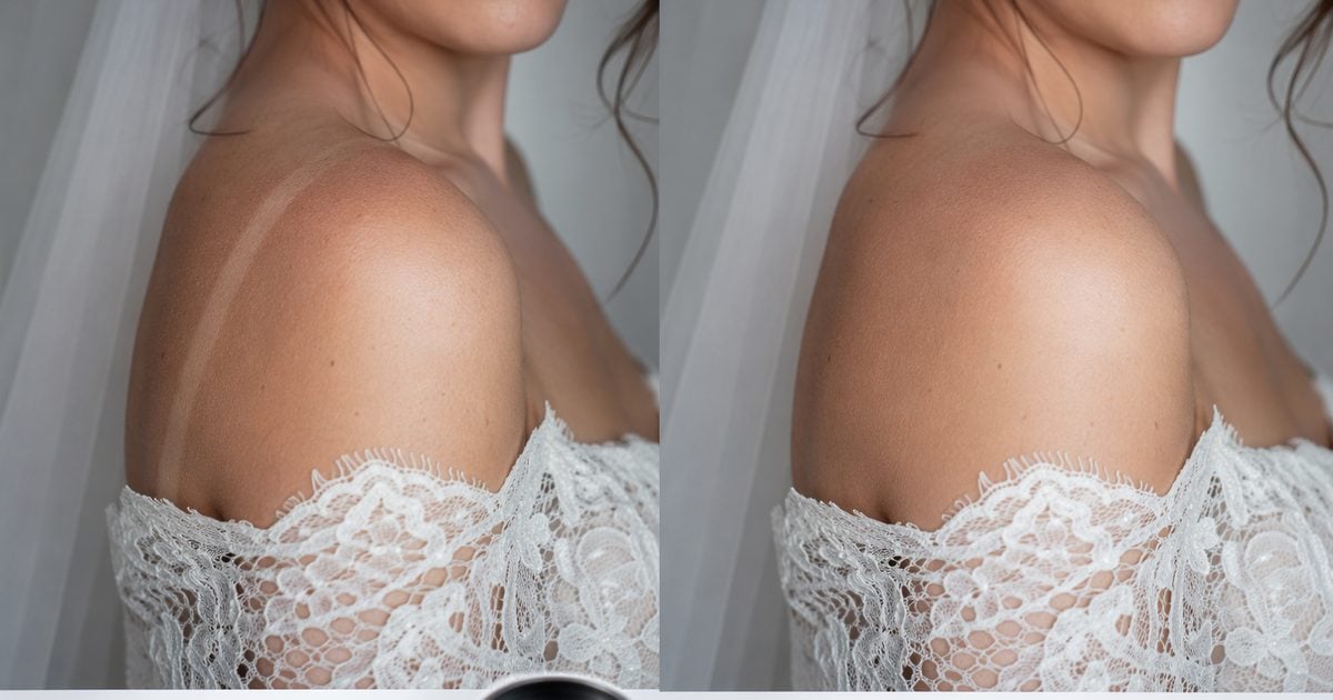 how to remove tan lines before after strap line natural texture preserved