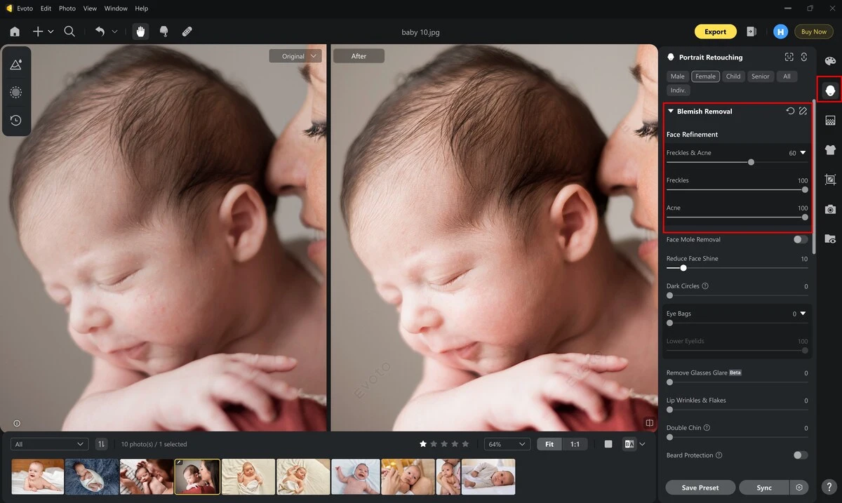 Retoque de pele de bebê em fotografia newborn sem perder a textura natural