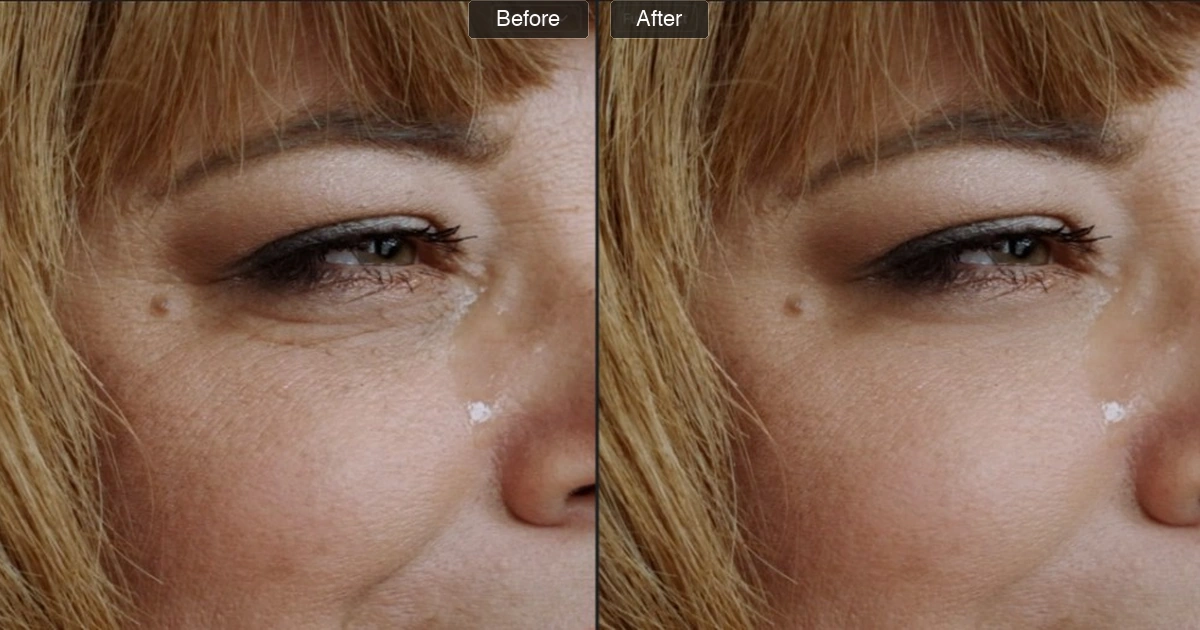 cover-remove-eye-bags-from-video cover remove eye bags from video