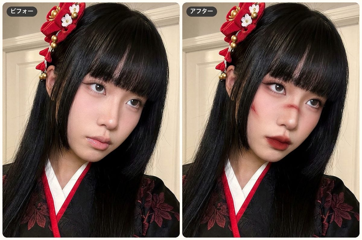 evoto-scar-glam-before-after evoto scar glam before after