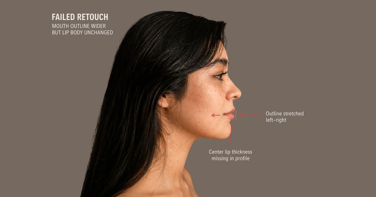 side profile lips wider not thicker annotated