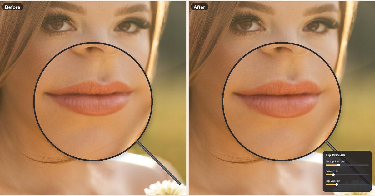 What Would I Look Like With Lip Filler in a Photo? Edit Methods That Work